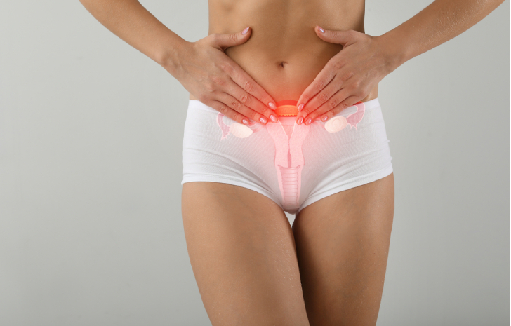 Poate exista endometrioză în afara uterului?