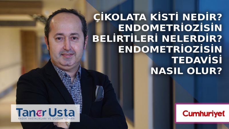 Çikolata kisti nedir? Endometriozisin belirtileri nelerdir? Endometriozisin tedavisi nasıl olur?