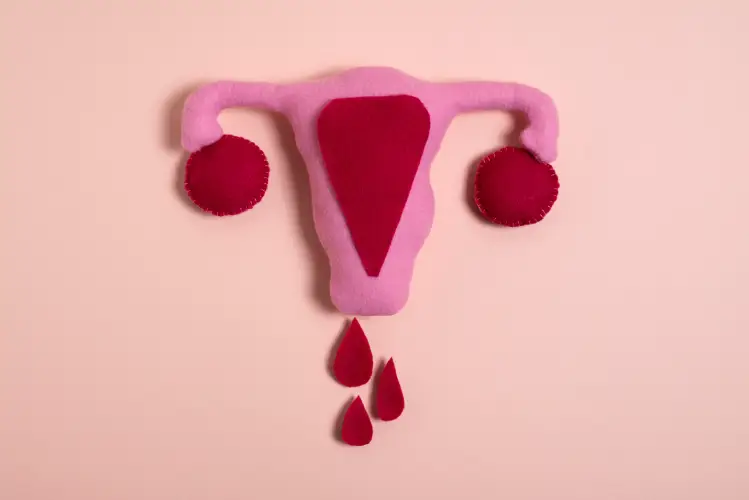 De ce sunt trecute atât de des cu vederea simptomele endometriozei profunde infiltrative?